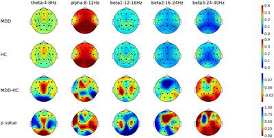 EEG-based major depressive disorder recognition by neural oscillation and asymmetry